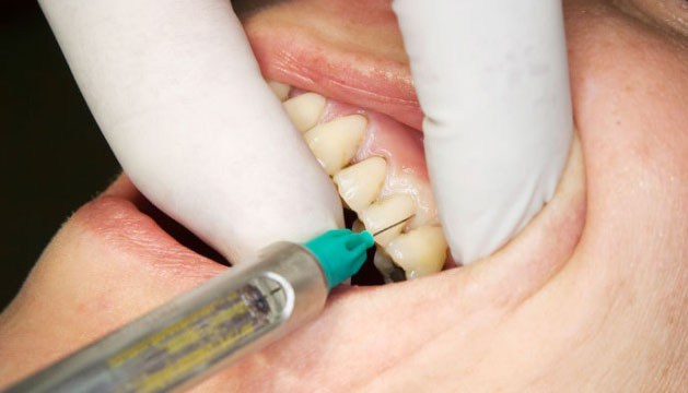Слабые десны шатаются зубы лечение народными средствами thumbnail