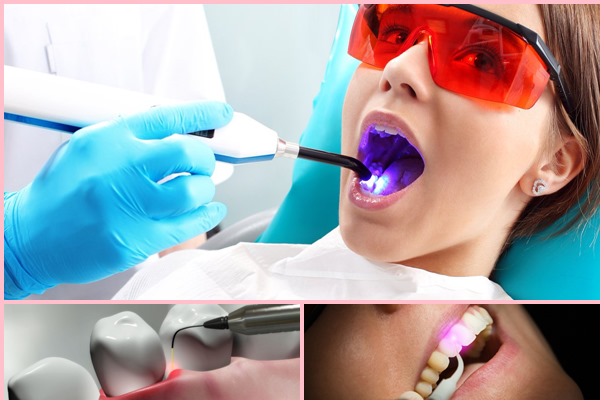 Как вылечить зубы от пародонтоза thumbnail