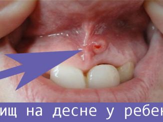 Дырка в десне