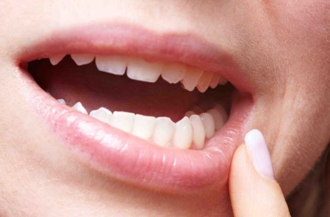 Онемение десны зубов после лечения зуба thumbnail