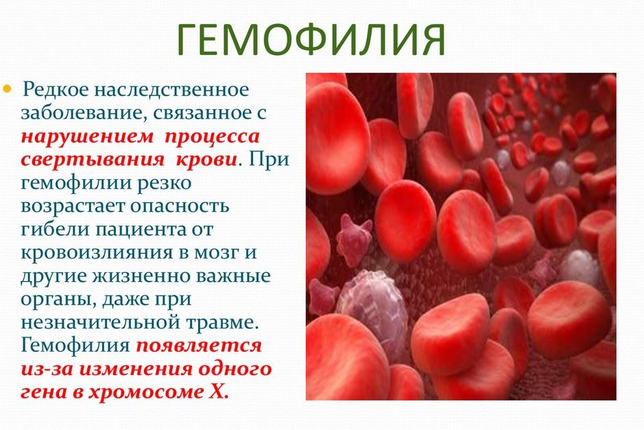 Болезни крови у мужчин. Заболевание гемофилия. Наследственные болезни крови. Гемофилия и заболевание крови. Гемофилия это наследственное заболевание.