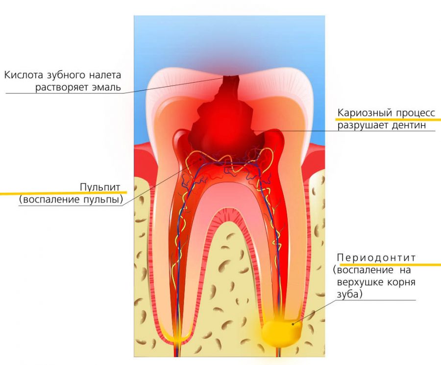 Болезни зубов и десен: причины, фото и названия у взрослых и детей
